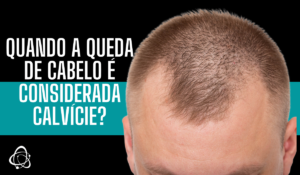 Quando a queda de cabelo é considerada calvície