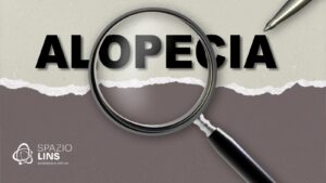 tipos de alopecia