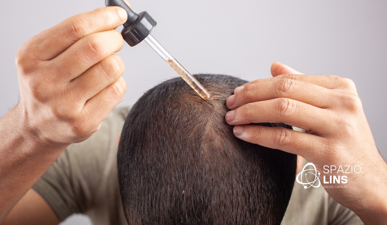 Quanto Tempo Leva para o Minoxidil Fazer Efeito? - Spazio Lins