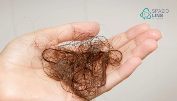 Quais os Maiores Mitos Sobre Queda de Cabelo e Como Desvendá-los?