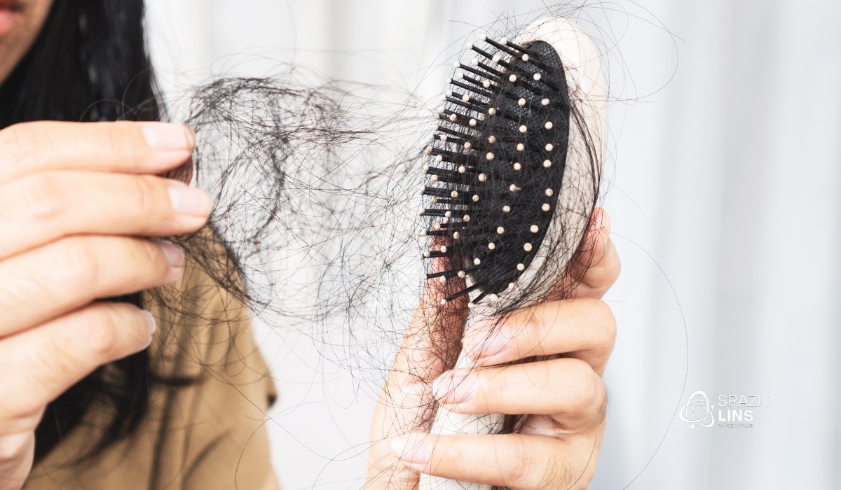 Como Resolver a Queda de Cabelo Feminina