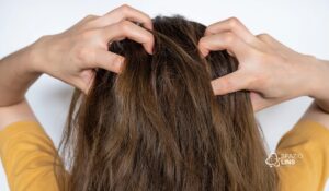 Como Saber se Tenho Alergia ao Shampoo: Sintomas, Causas e Tratamentos