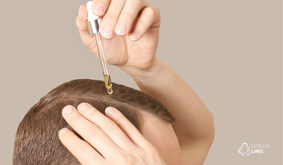 Efeito Shedding do Minoxidil: o que é, quanto tempo dura e quando se preocupar