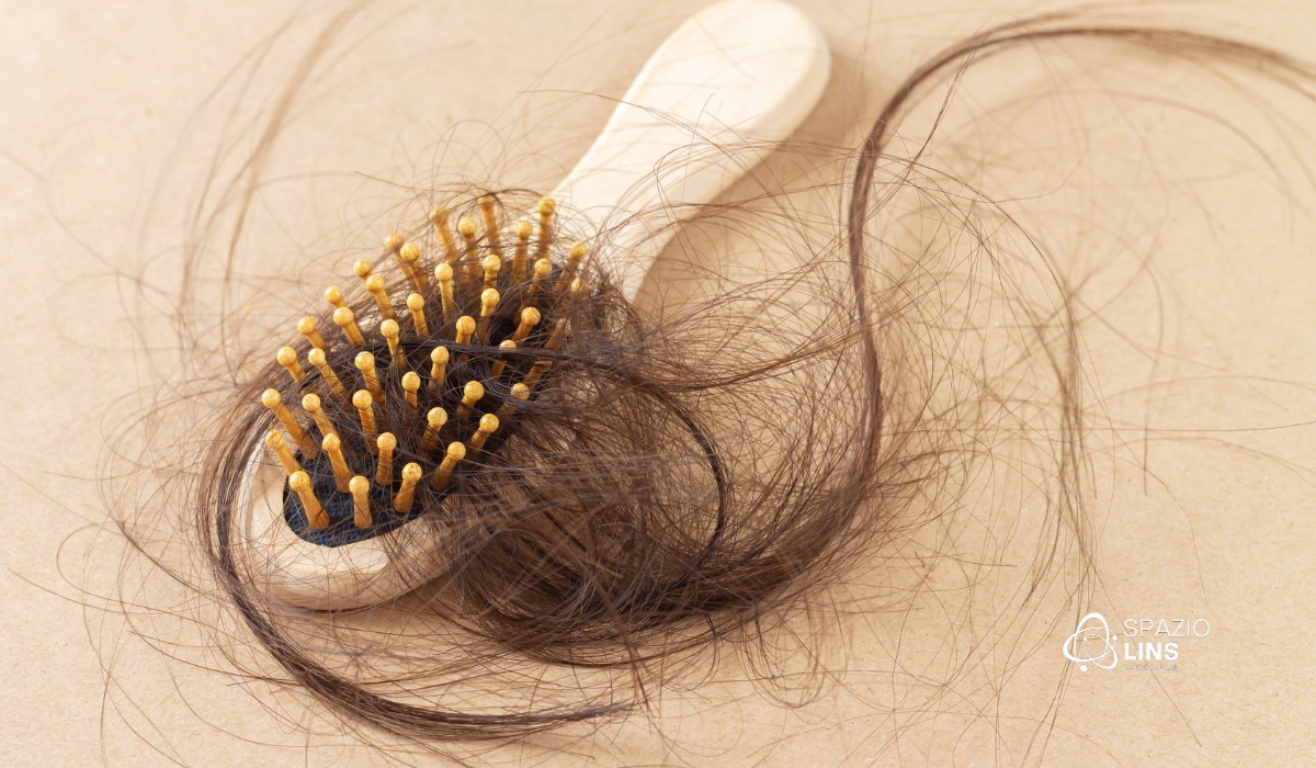 Queda de cabelo após a cirurgia bariátrica: causas, duração e como tratar