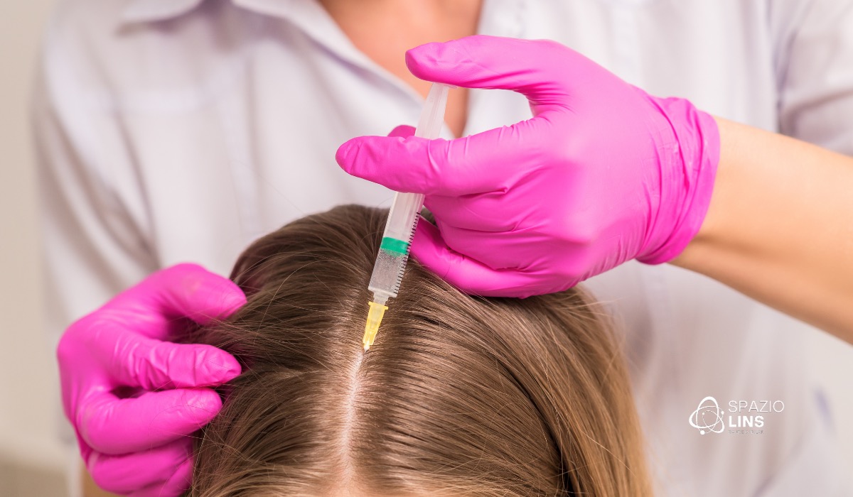 O que é alopecia androgenética? Entenda as causas, sintomas e tratamentos
