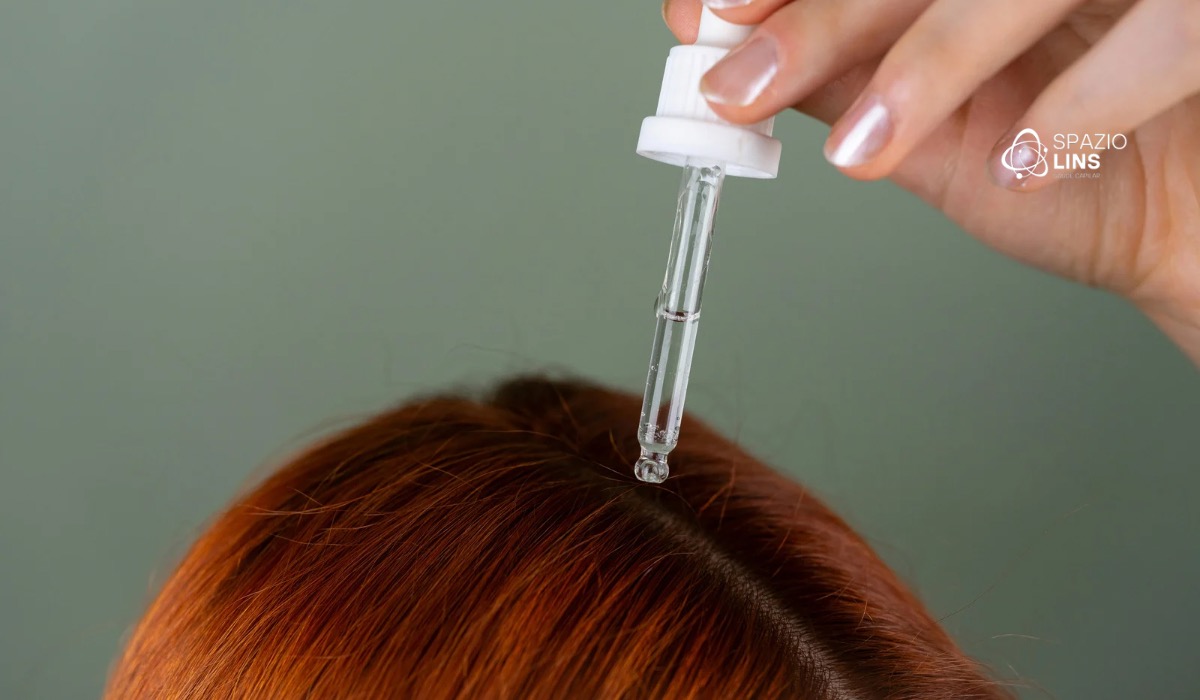 Por que o tratamento capilar na Spazio Lins vai além do minoxidil?