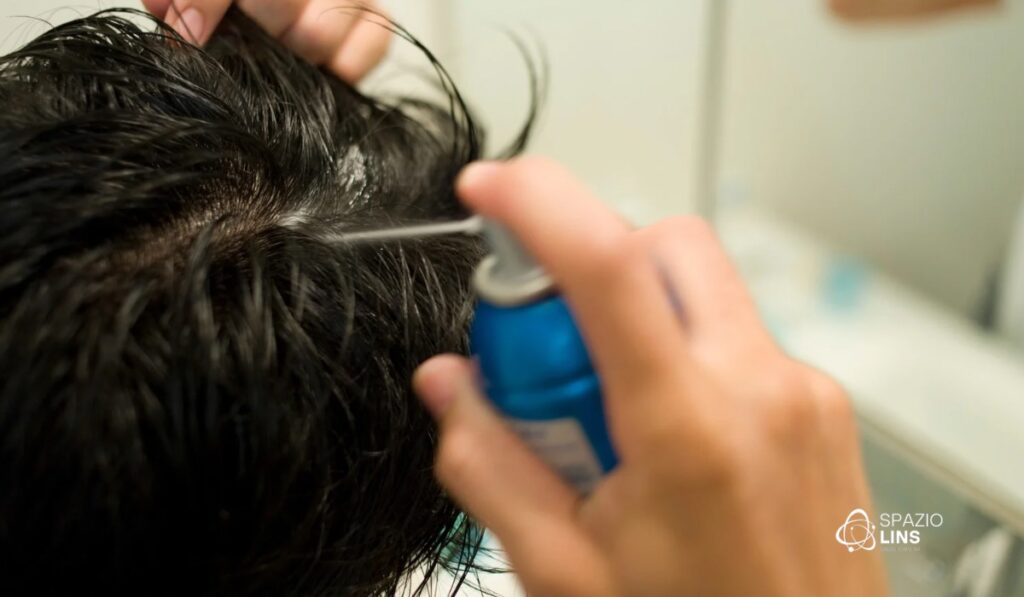 Por que o tratamento capilar na Spazio Lins vai além do minoxidil?