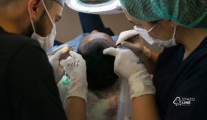 Por que fazer transplante sem tratamento capilar é um erro?