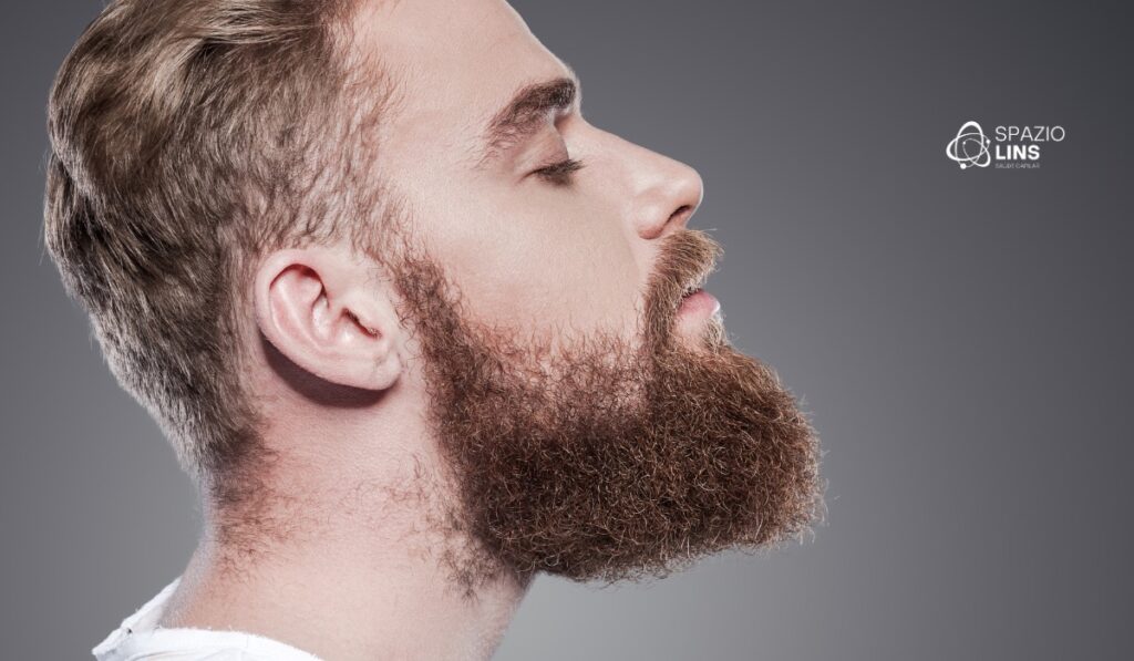 É possível escolher o formato da barba no transplante? Veja como funciona