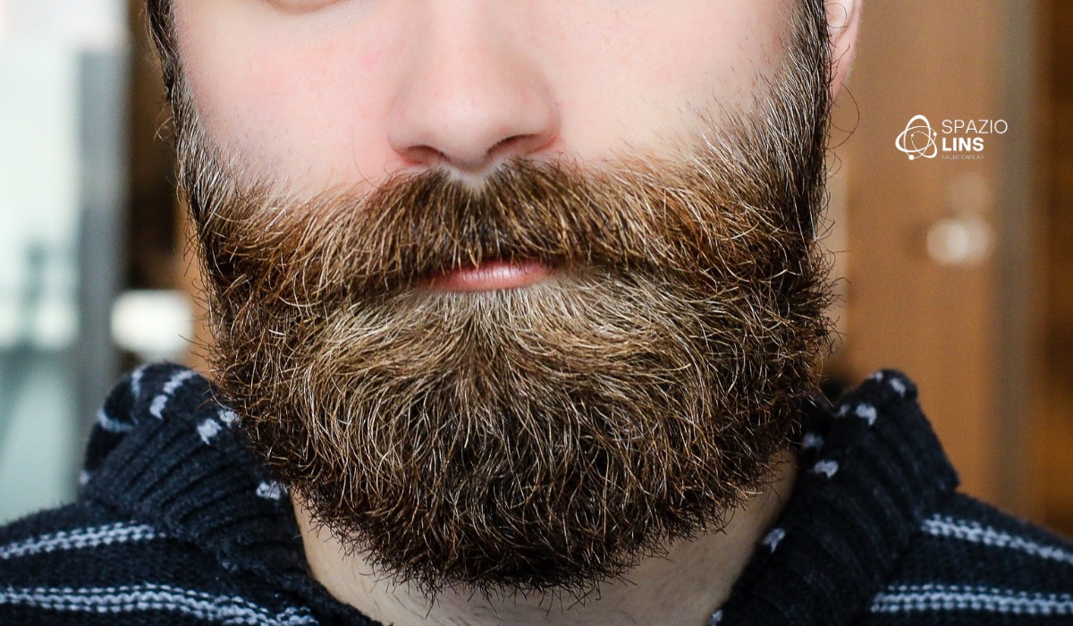 É possível escolher o formato da barba no transplante? Veja como funciona