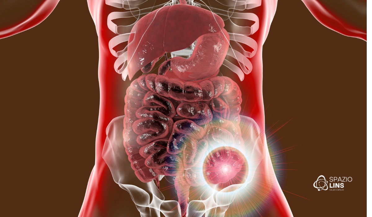 Interação entre saúde intestinal e capilar: como o intestino impacta os fios