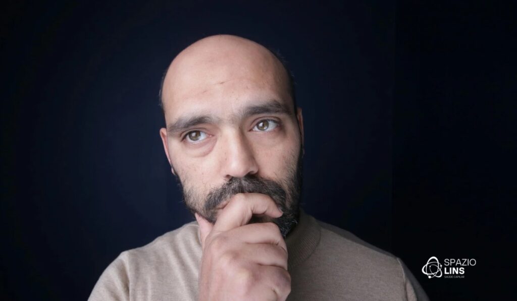 Calvície masculina x feminina: diferenças no diagnóstico e tratamento