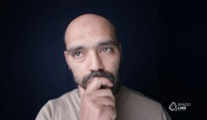 Calvície masculina x feminina: diferenças no diagnóstico e tratamento