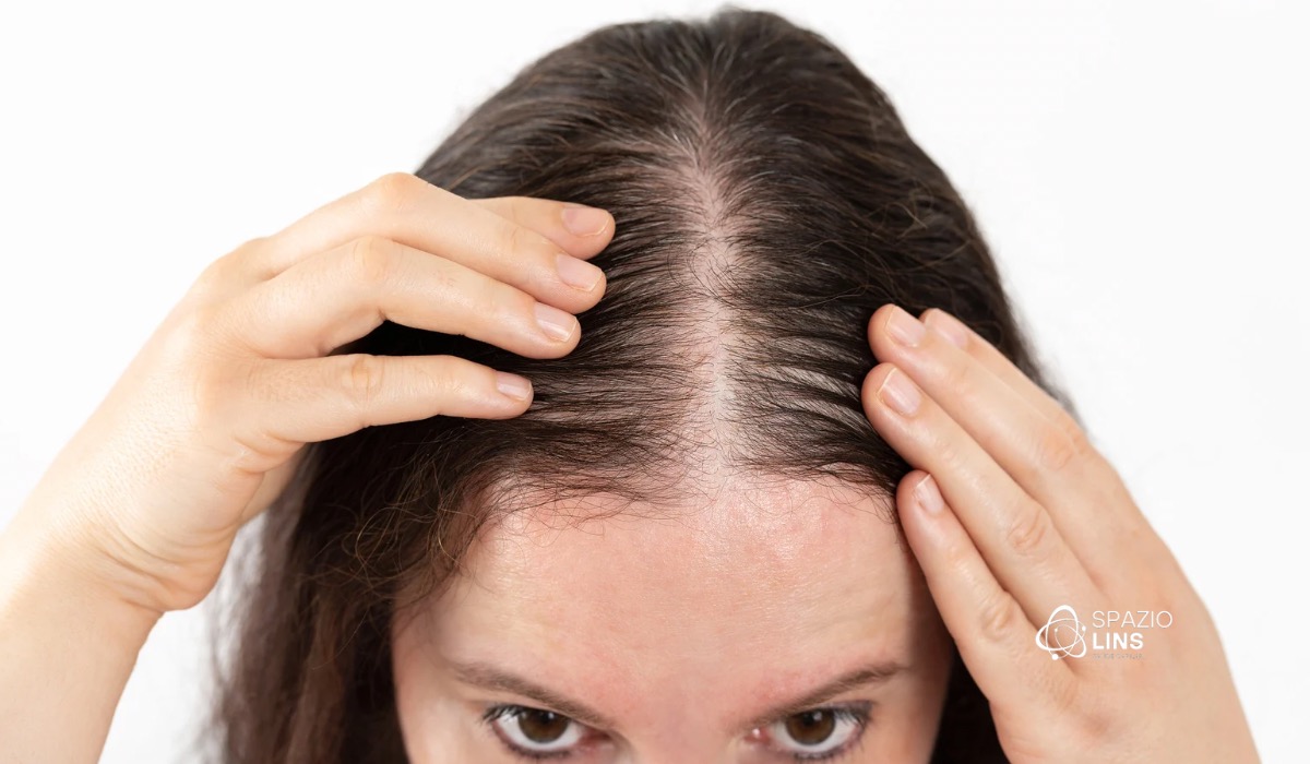 Queda de cabelo em jovens pode ser sinal de alerta. Descubra causas, sinais preocupantes e tratamentos eficazes na Spazio Lins