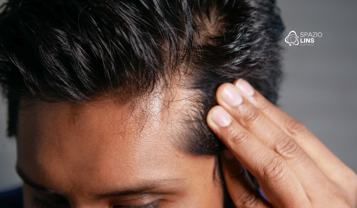 Adolescentes com queda de cabelo: descubra as causas mais comuns, como tratar sem pânico e conheça os protocolos exclusivos da Spazio Lins.
