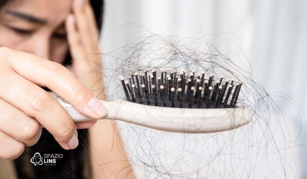 Eflúvio Telógeno: Queda de Cabelo Temporária ou Início de Calvície?