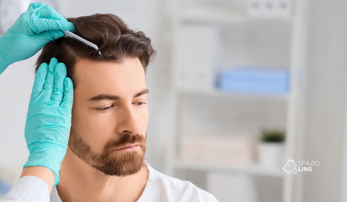 Calvície não é só genética: fatores que ninguém te contou