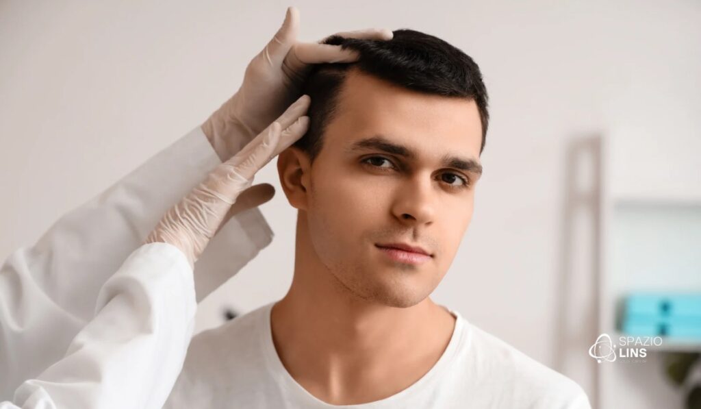 Queda de cabelo em homens: sinais de alopecia androgenética que você não pode ignorar