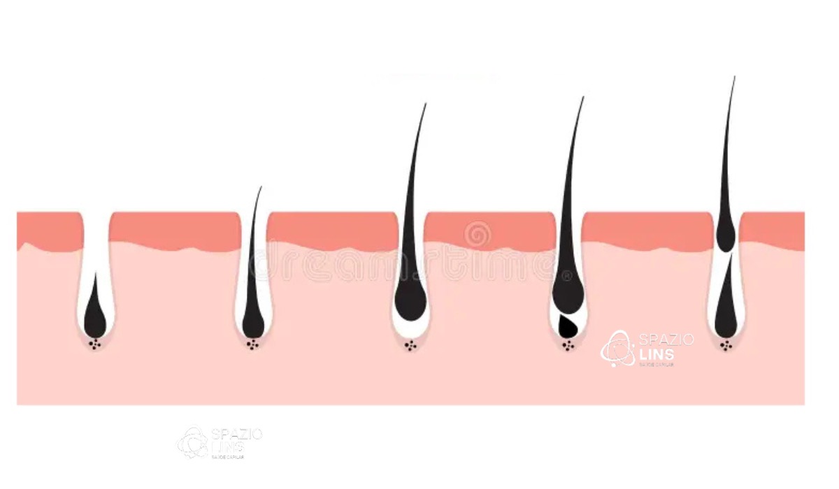 Ciclo capilar: como funciona e por que a queda aumenta em algumas fases
