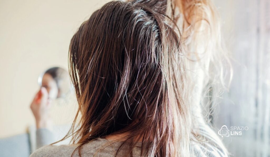 Oleosidade excessiva no couro cabeludo: quando o sebo causa queda e como tratar de forma eficaz