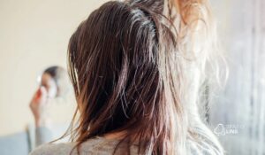 Oleosidade excessiva no couro cabeludo: quando o sebo causa queda e como tratar de forma eficaz