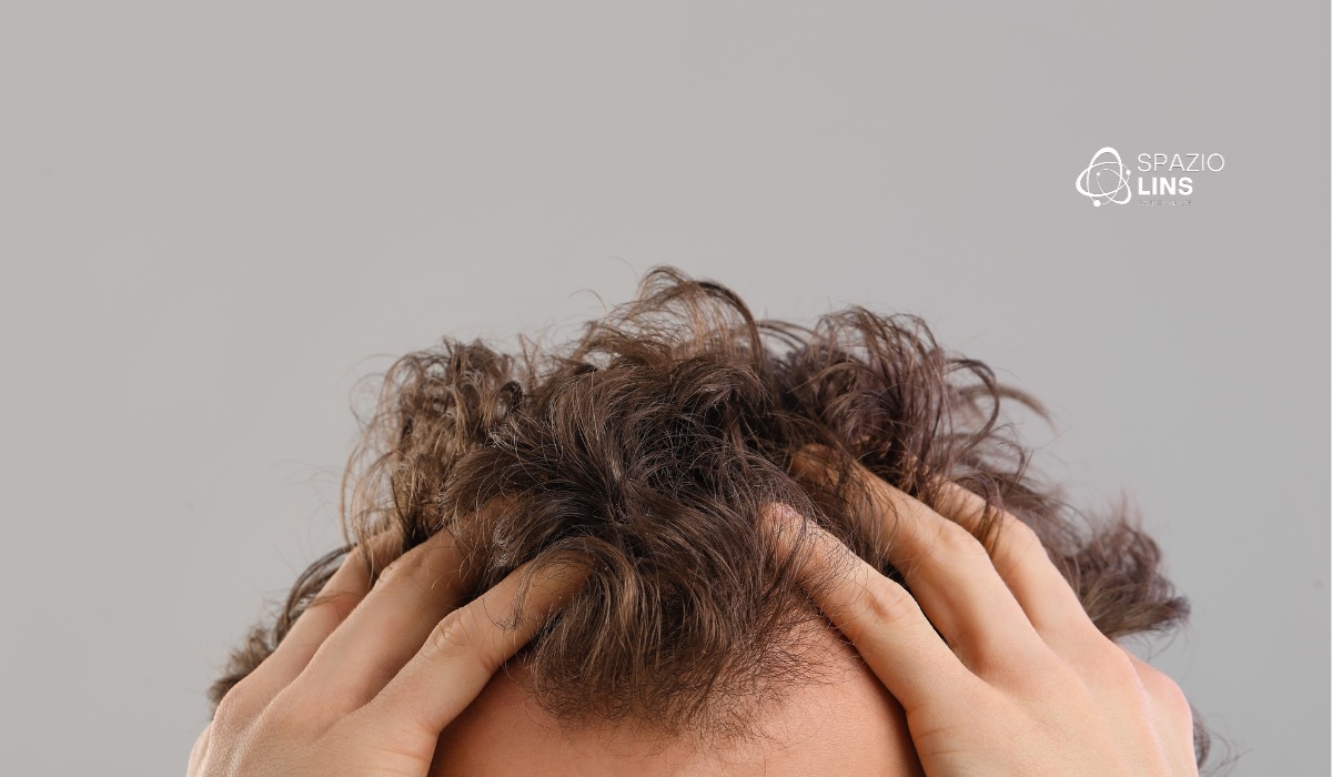 Queda pós-anestesia: por que acontece e como recuperar os fios