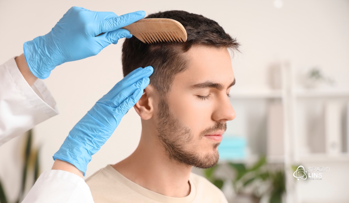 Calvície precoce: como identificar e prevenir a alopecia antes dos 30 anos