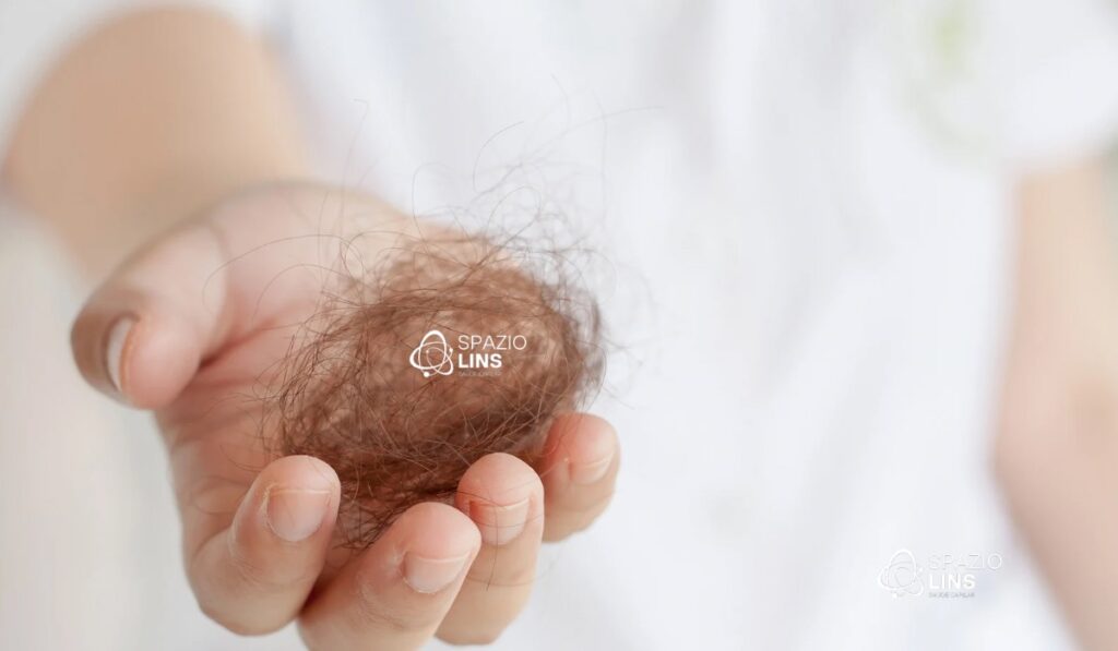 Eflúvio telógeno queda de cabelo intensa tem cura