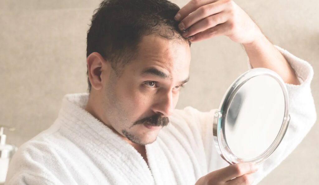 Queda de cabelo após COVID, cirurgia ou doença é normal