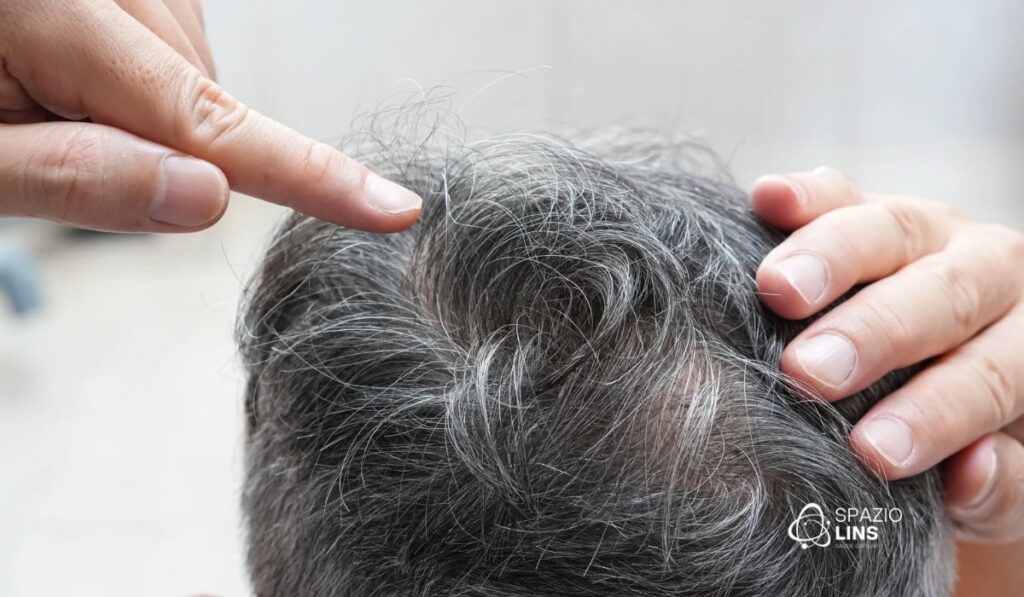 Perda de densidade capilar com a idade: como prevenir e tratar cedo