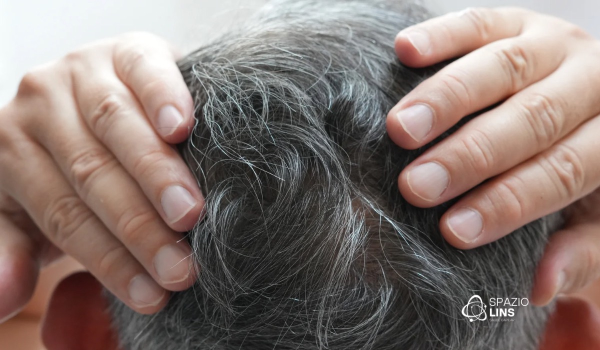 Perda de densidade capilar com a idade: como prevenir e tratar cedo