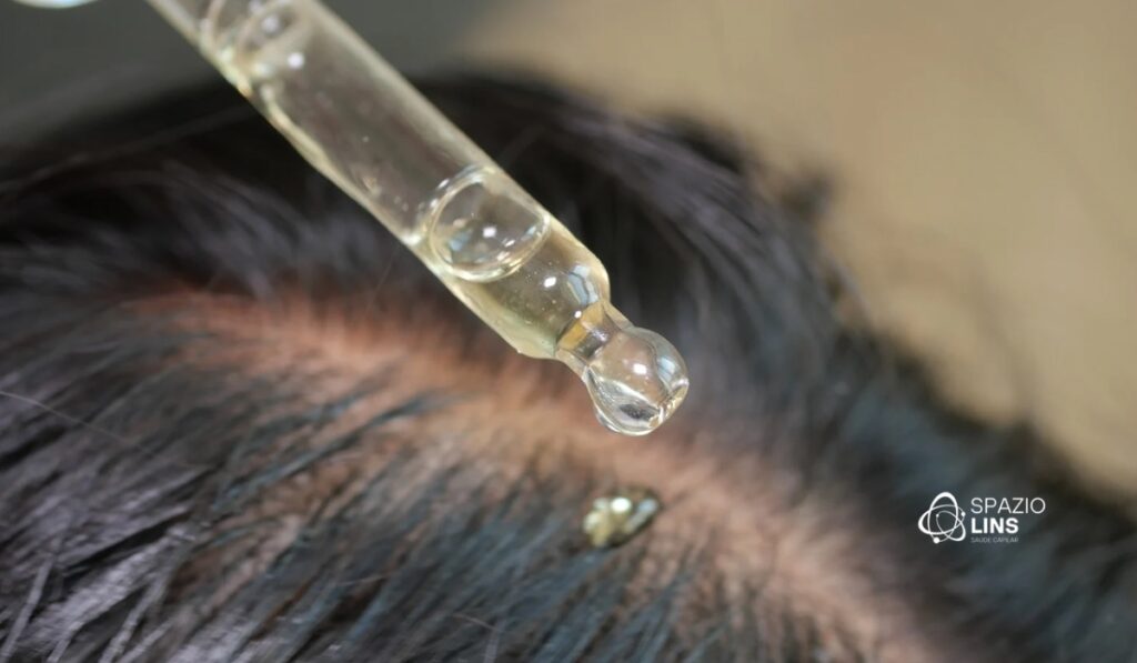 Quando o couro cabeludo inflama: causas, consequências e tratamento preventivo