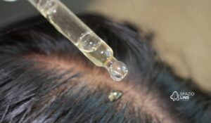 Quando o couro cabeludo inflama: causas, consequências e tratamento preventivo