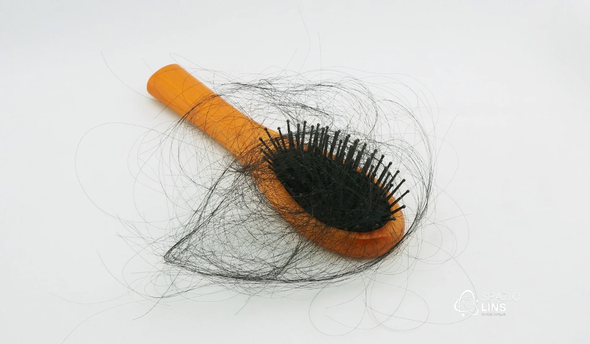 Eflúvio telógeno: quando a queda de cabelo não é genética