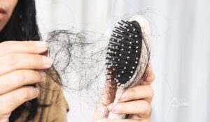 Quando a queda de cabelo deixa de ser normal e vira um problema?
