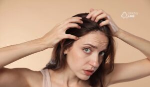 Calvície feminina: por que acontece e quais são os melhores tratamentos?