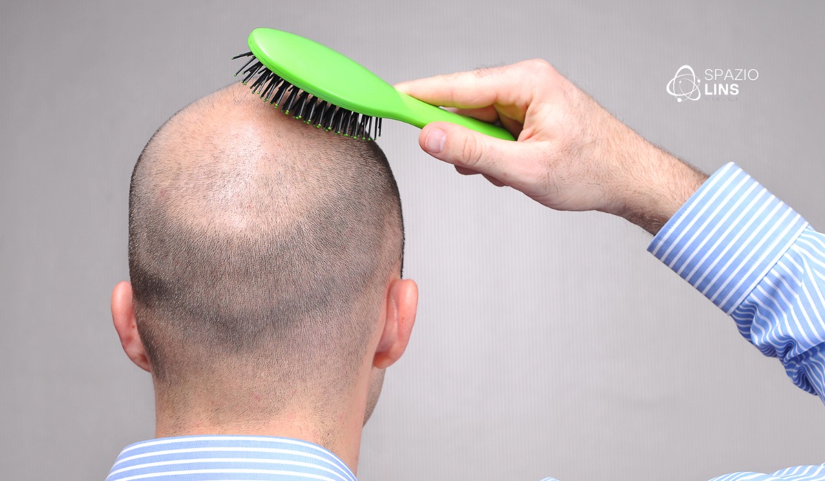 7 erros que estão piorando a sua queda de cabelo (e você nem percebe)