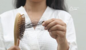 Eflúvio telógeno: queda de cabelo intensa tem cura? Entenda causas, tratamento e recuperação