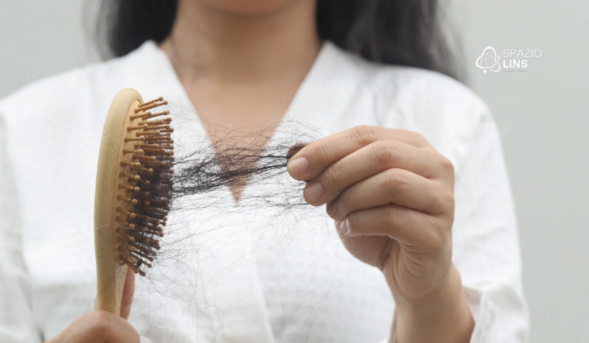 Eflúvio telógeno: queda de cabelo intensa tem cura? Entenda causas, tratamento e recuperação