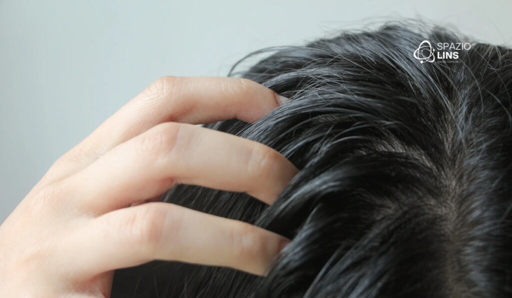 Oleosidade no couro cabeludo causa queda de cabelo? Entenda a verdade