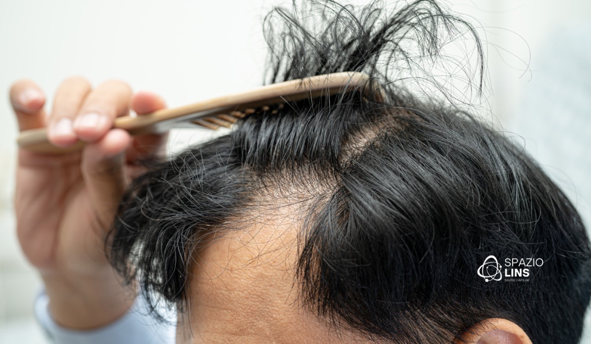 Queda de cabelo: o que pode estar causando e quando é sinal de alerta?