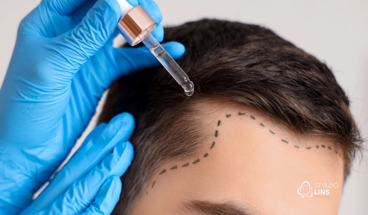 Tratamento para queda de cabelo funciona mesmo?