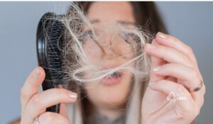 Queda de cabelo após covid, cirurgia ou doença: é normal?