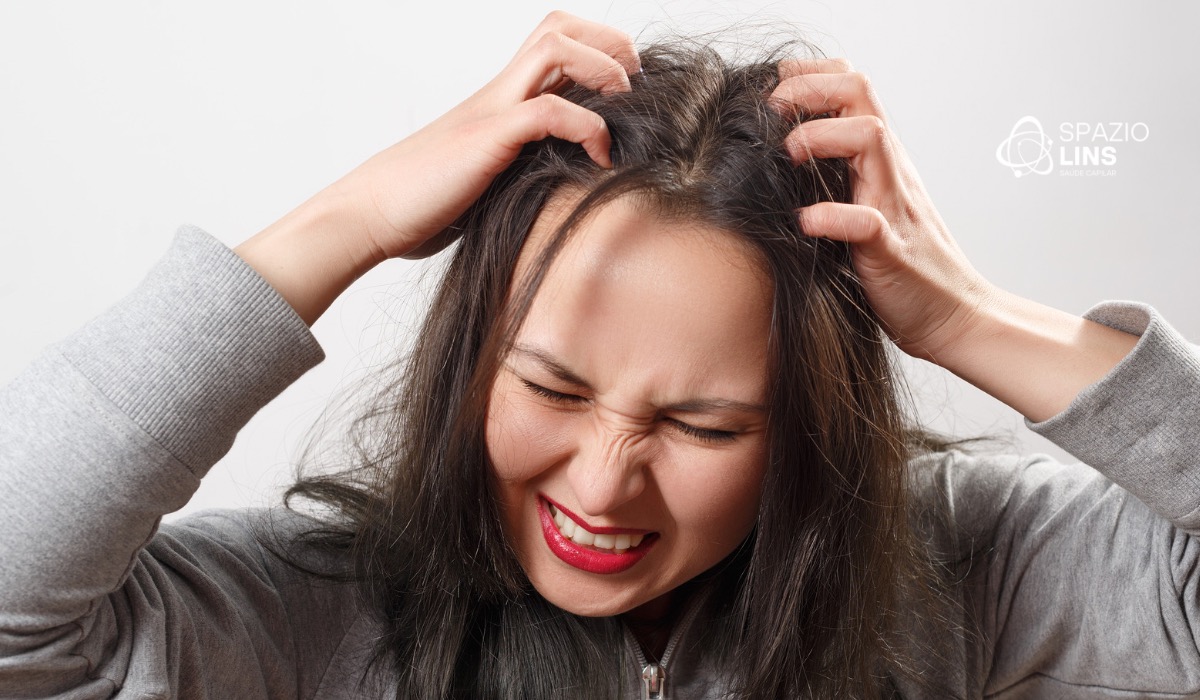 Coceira no couro cabeludo pode indicar alopecia? Entenda os sinais de alerta