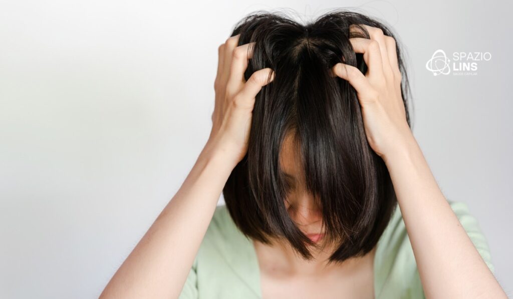 Coceira no couro cabeludo pode indicar alopecia? Entenda os sinais de alerta