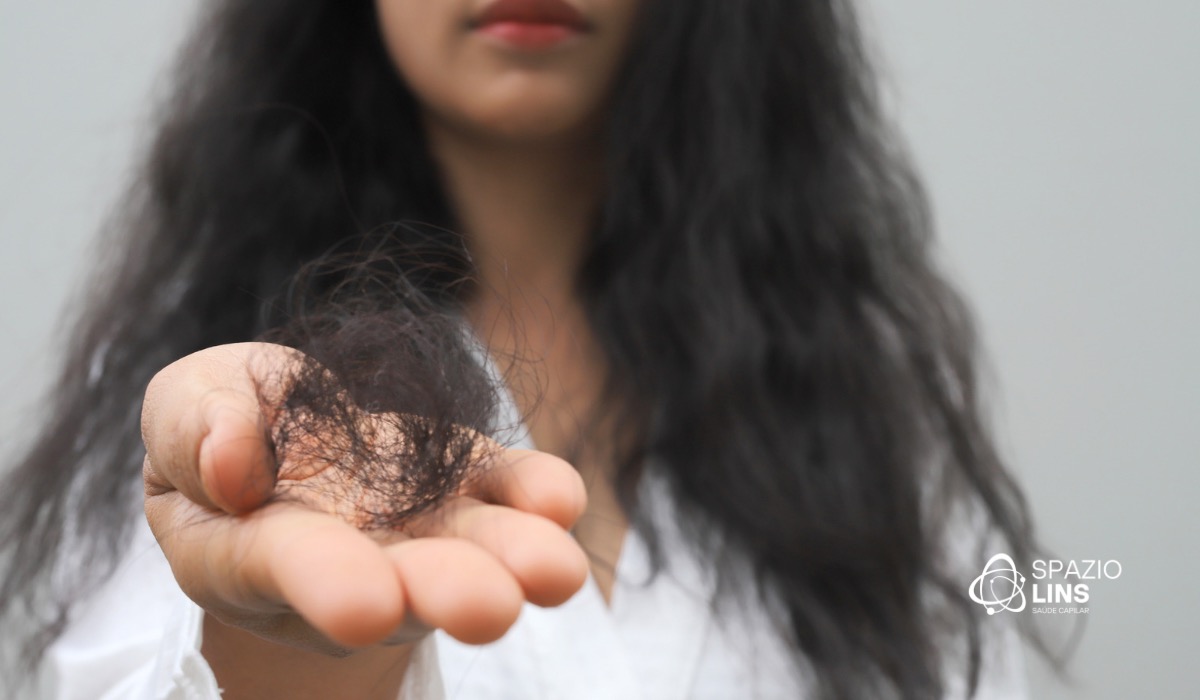 Cabelo caindo pela raiz: o que significa?