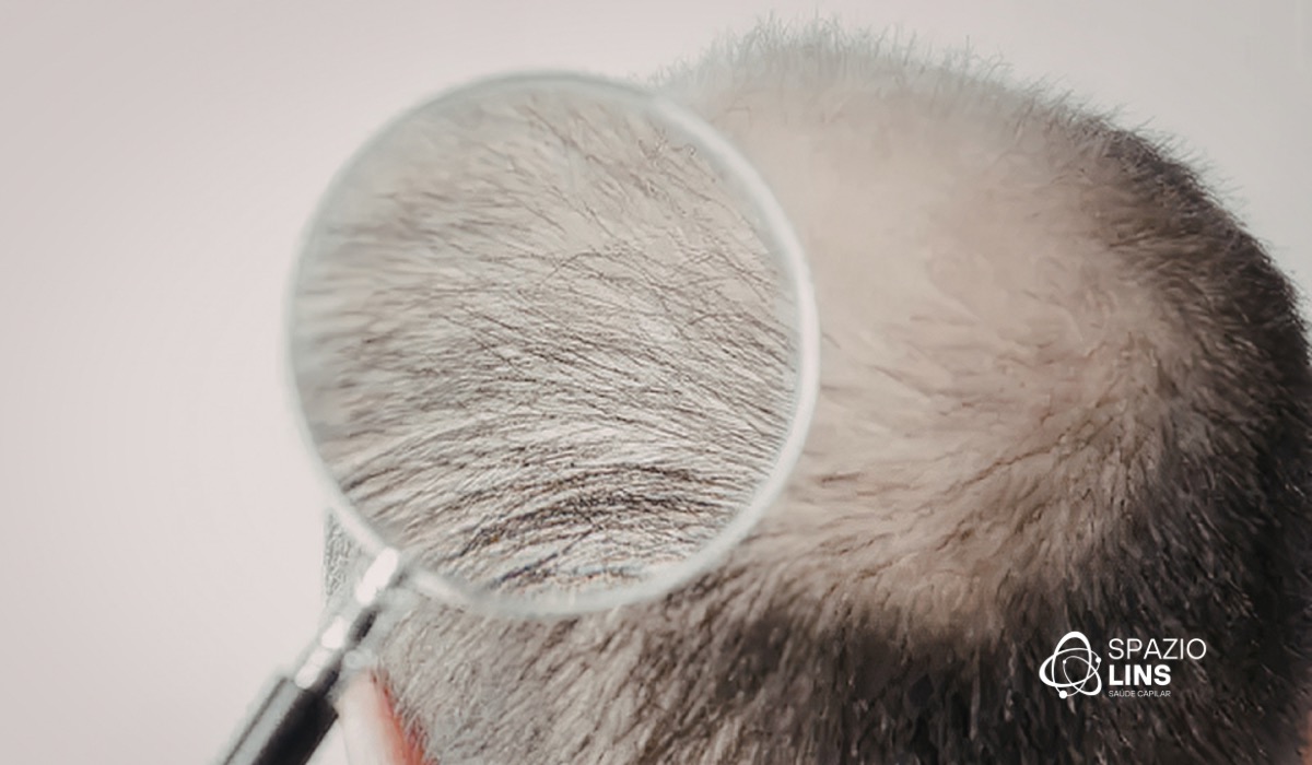 Por que o cabelo fica mais fino com o passar dos anos? Entenda as principais causas