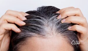 Por que o cabelo fica mais fino com o passar dos anos? Entenda as principais causas