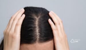 Cabelo ficando ralo? Entenda o que pode estar acontecendo