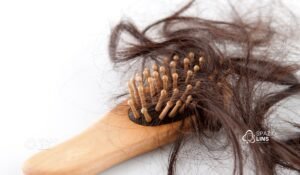 Cabelo caindo muito: quando a queda deixa de ser normal?